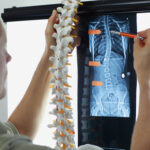 How a Lawyer Can Help You If You’ve Suffered a Spinal Cord Injury